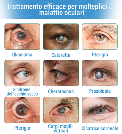 👩‍⚕️ Ourlyard® Collirio Supramolecolare ✅ Certificato CE (Adatto per cataratta, presbiopia, degenerazione maculare e occhio secco)